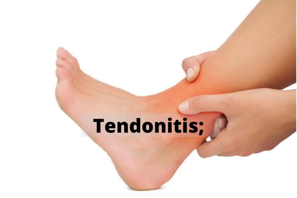 Tendonitis