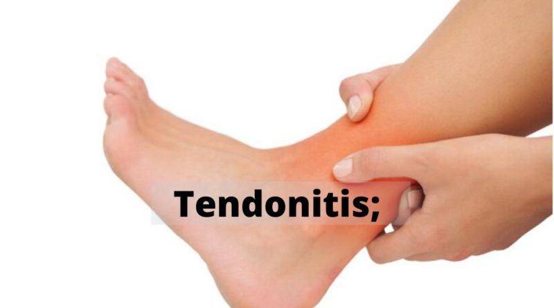 Tendonitis