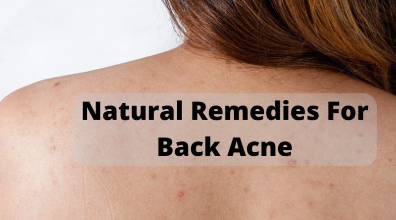 treatments for back acne