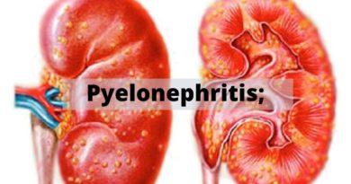 Pyelonephritis