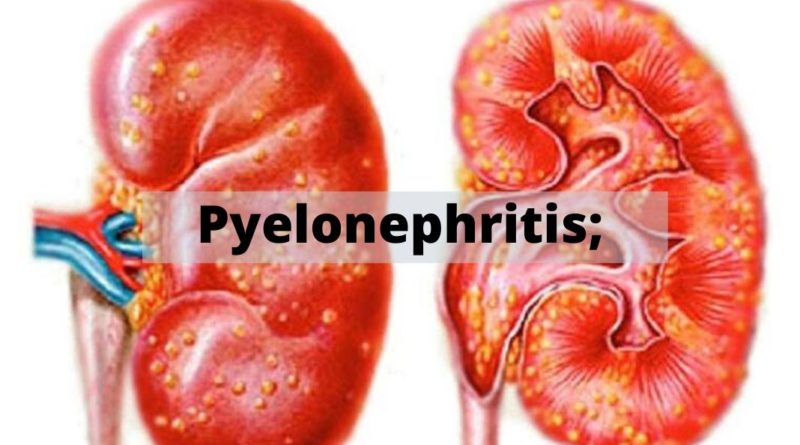 Pyelonephritis