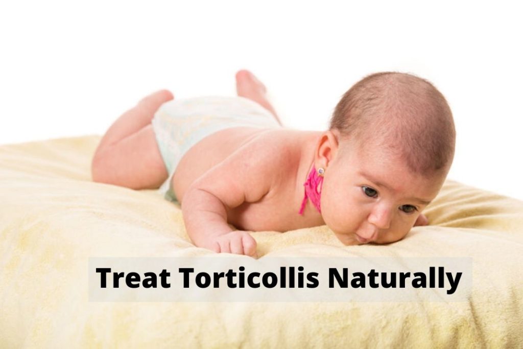 Treat Torticollis Naturally