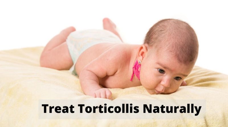 Treat Torticollis Naturally