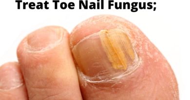 Toe Nail Fungus