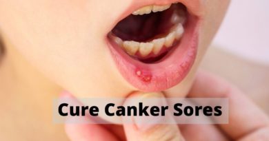 Cure Canker Sores