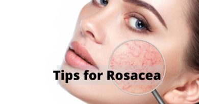 tips for rosacea
