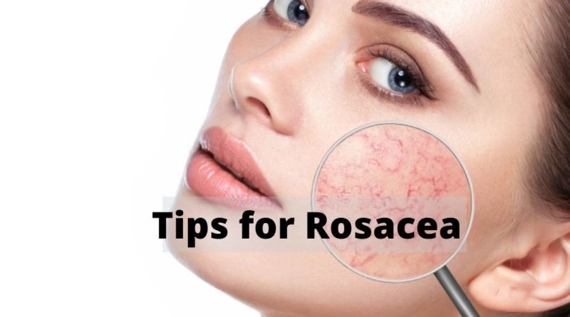 tips for rosacea