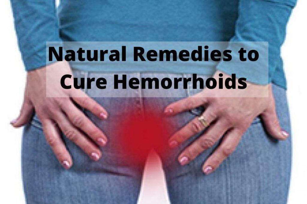 Natural Remedies to Cure Hemorrhoids