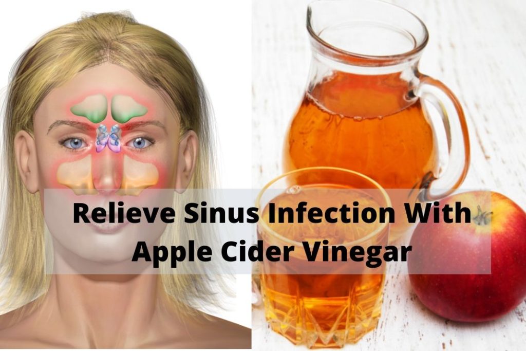 Relieve Sinus Infection With Apple Cider Vinegar