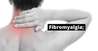 Fibromyalgia