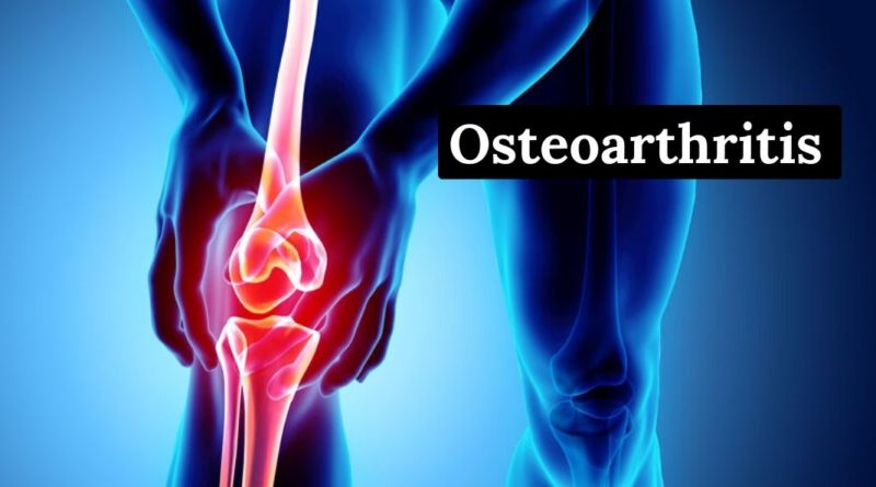 osteoarthritis