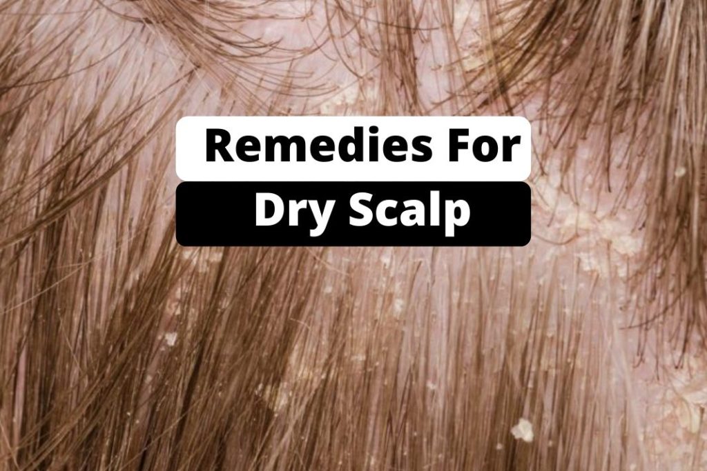 Remedies for Dry Scalp