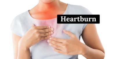 heartburn