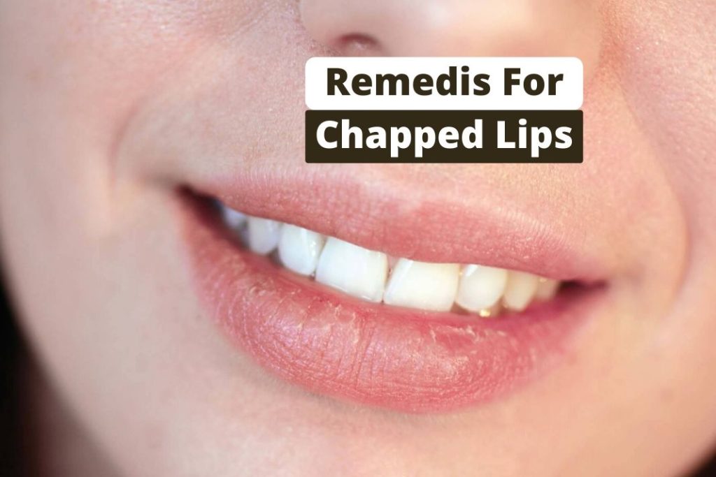 remedies for Chapped Lips