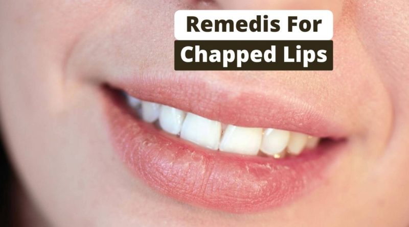 remedies for Chapped Lips