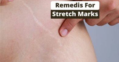 remedies for Stretch Marks