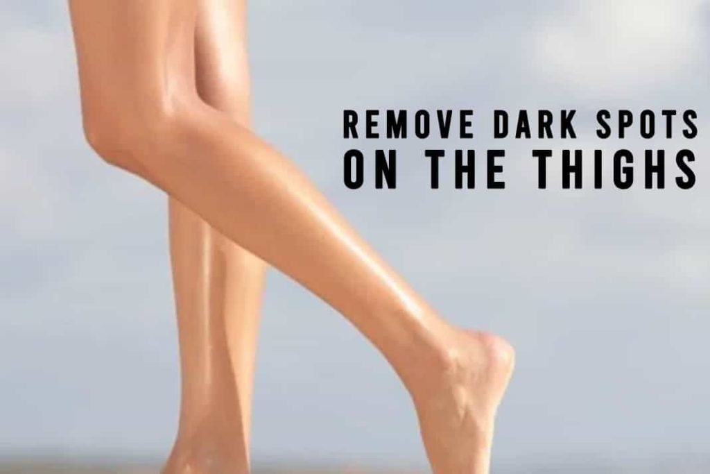 remove dark spots on thighs