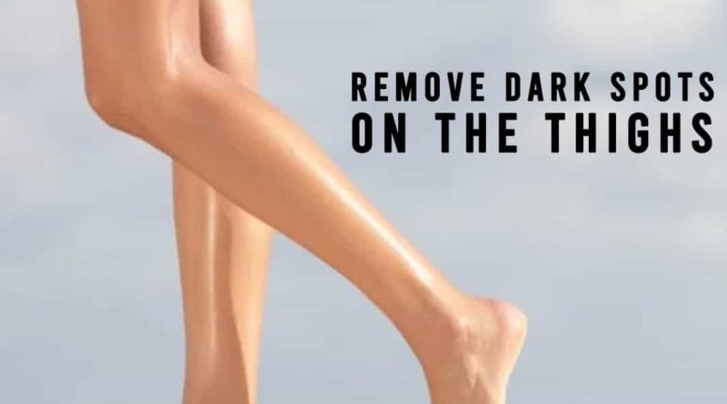 remove dark spots on thighs