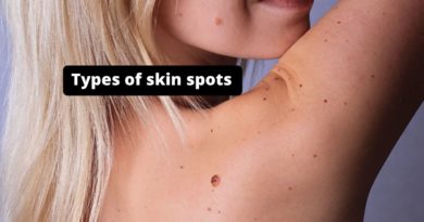 Types of skin spots