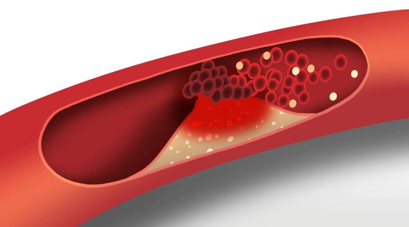 regulate cholesterol