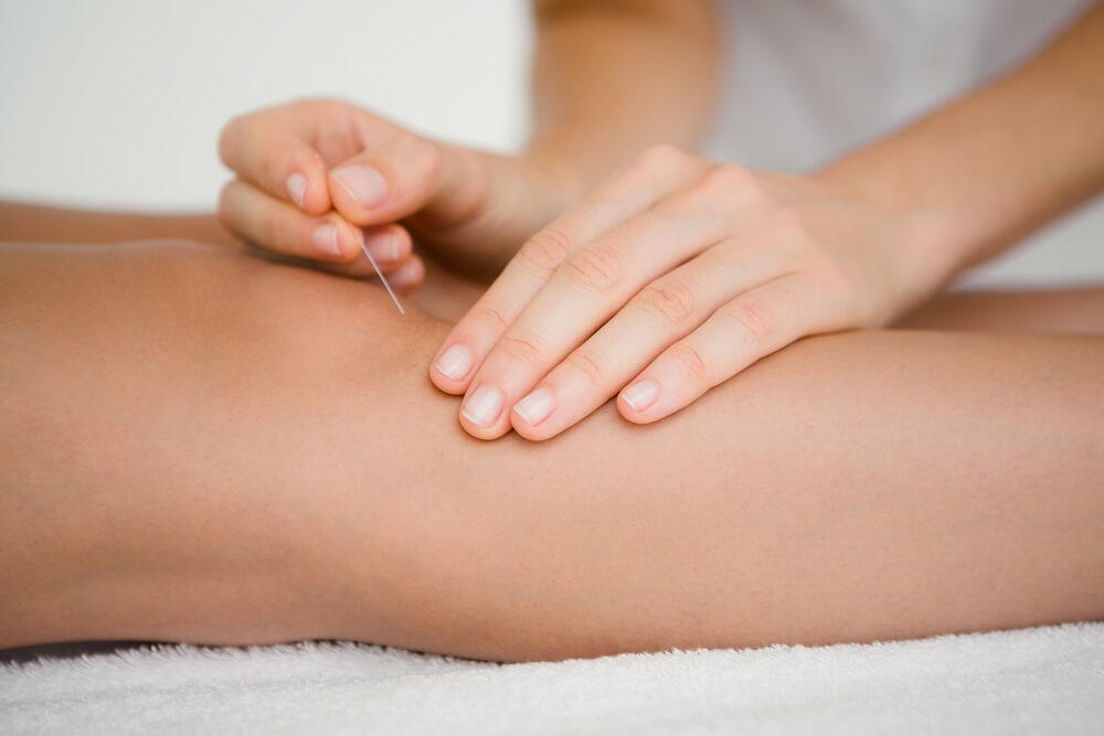 Acupuncture For Knee Pain