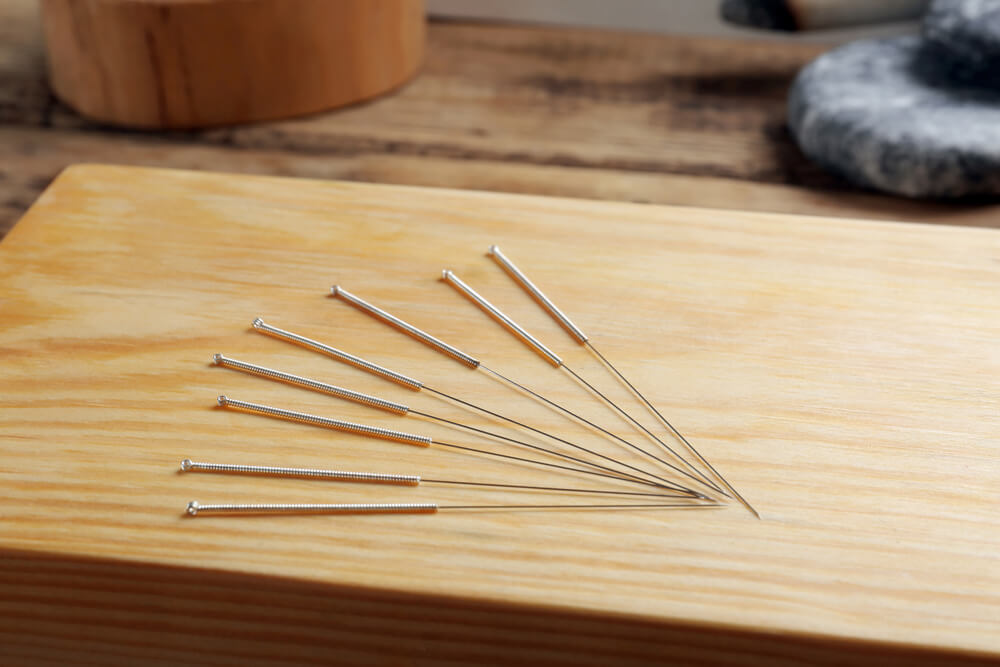 Acupuncture Needles