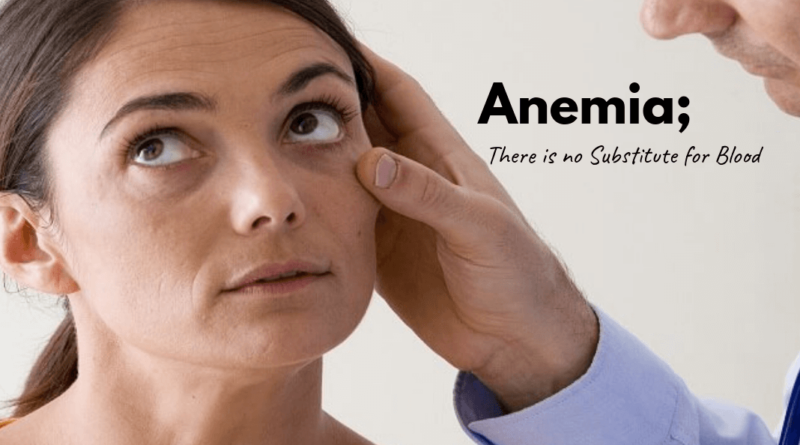 Anemia