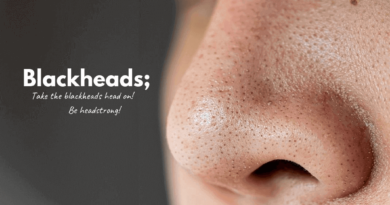 Blackheads