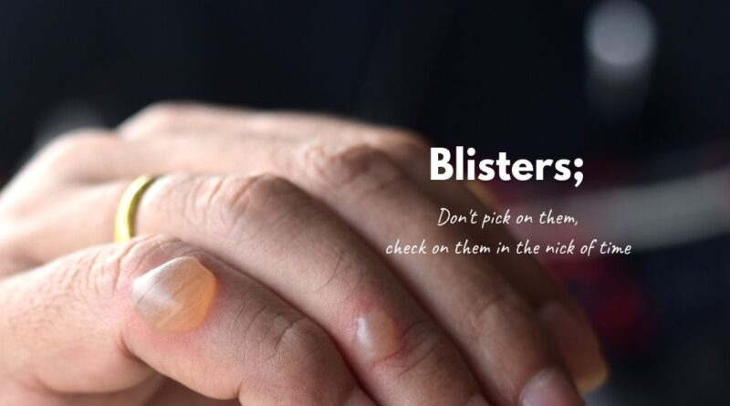 Blisters