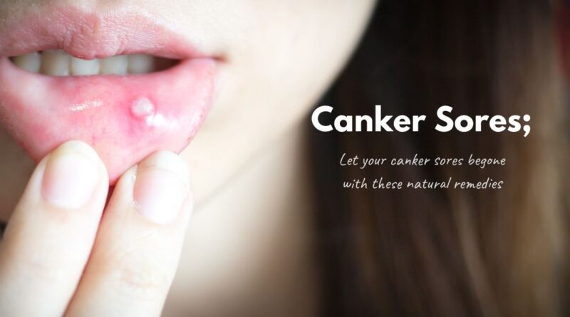 Canker Sores