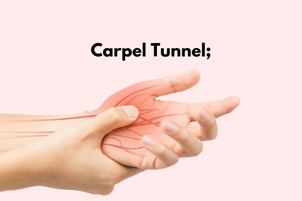 Carpal Tunnel