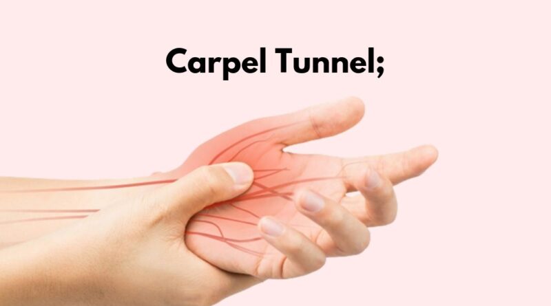 Carpal Tunnel