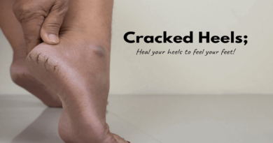 Cracked Heels