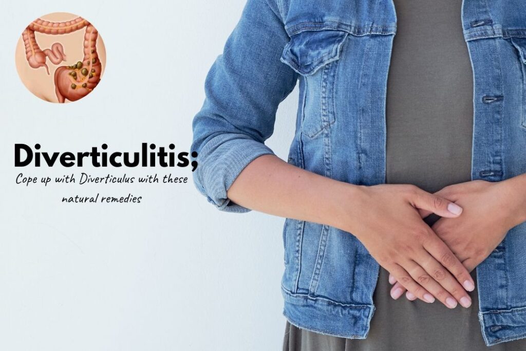 Diverticulitis