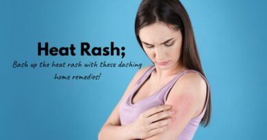 How To Cure Heat Rash