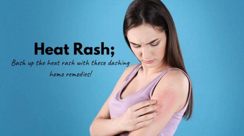 How To Cure Heat Rash