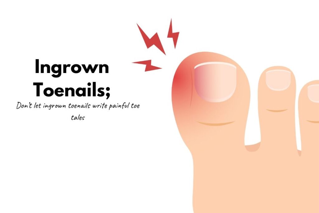 How To Get Rid Of Ingrown Toenails