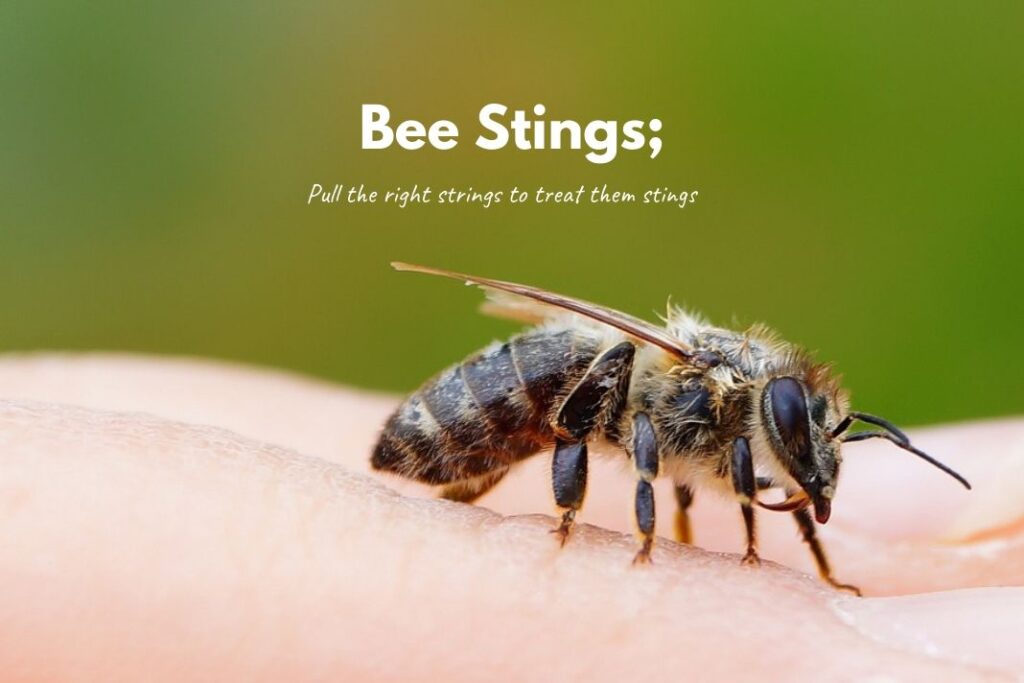 How To Treat Bee Stings