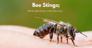 How To Treat Bee Stings