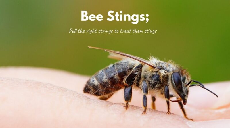 How To Treat Bee Stings