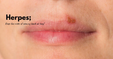 How to Treat Herpes
