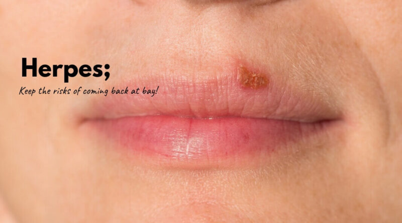 How to Treat Herpes