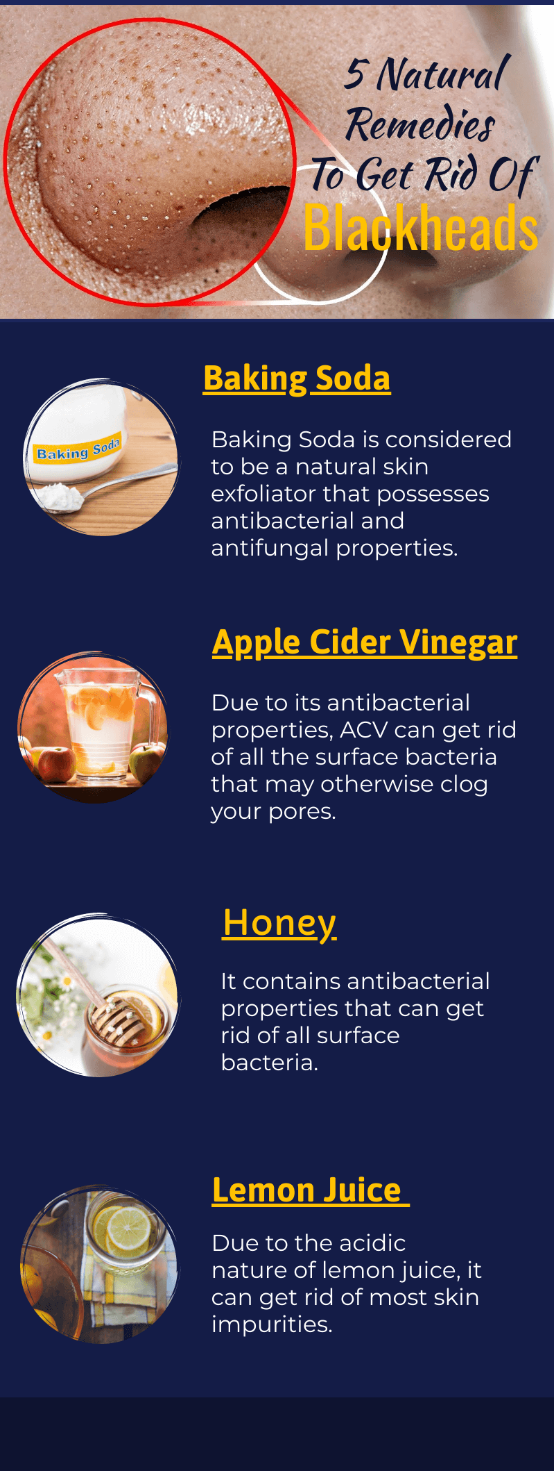How to get rid of blackheads Infographic