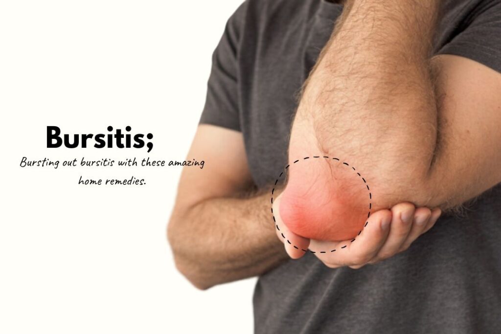 How to treat bursitis