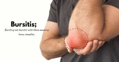 How to treat bursitis