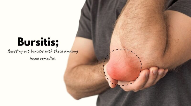 How to treat bursitis