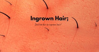 Ingrown Hair