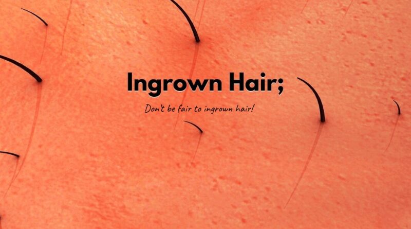 Ingrown Hair