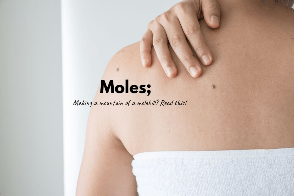 Moles