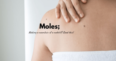 Moles